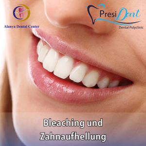 preis zahnbleaching