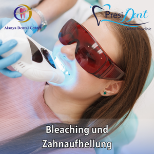 zahnbleaching antalya