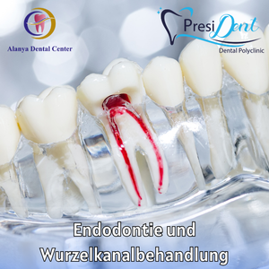 zahnkrone - kieferchirurg alanya